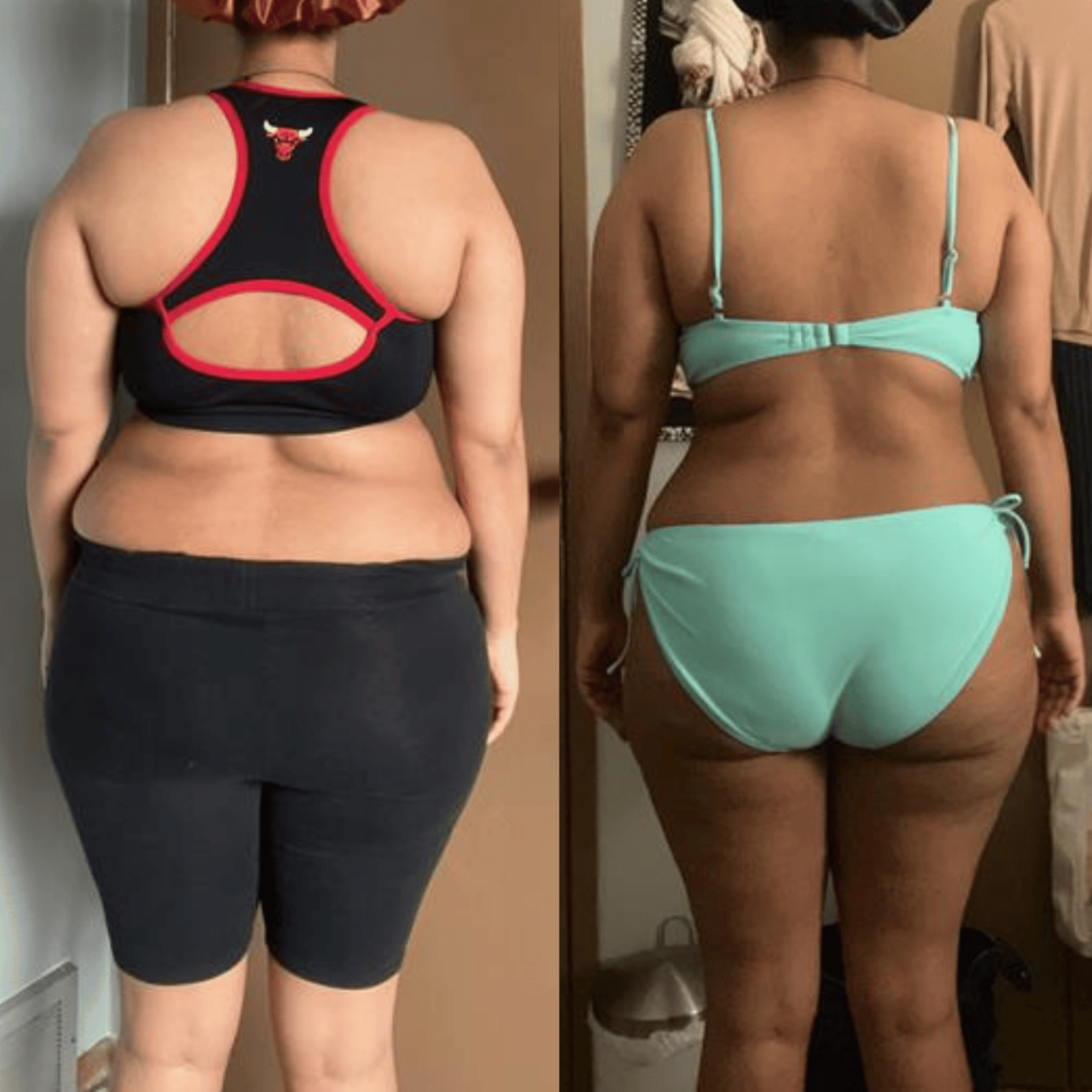Karen — Weight Loss Transformation