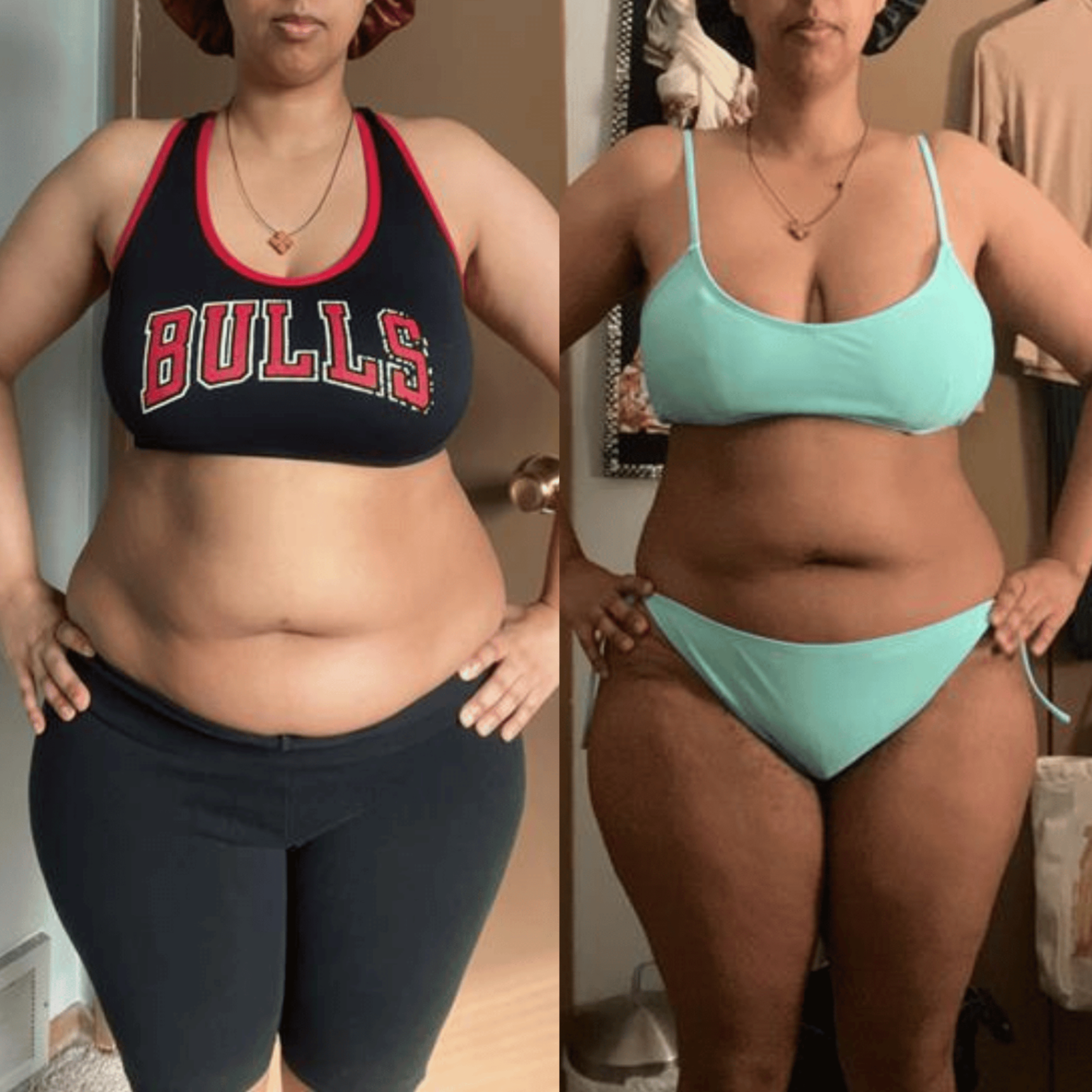 Karen — Weight Loss Transformation
